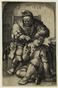 Prent van een chirurgijn die een insnijding maakt achter het oor van een voor hem op de grond zittende man. Lucas van Leijden, 1524. Bron: Rijksmuseum, Amsterdam.